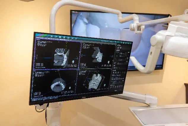 マイクロスコープ